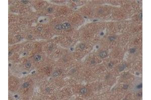 Detection of CX3CL1 in Human Liver Tissue using Polyclonal Antibody to Chemokine C-X3-C-Motif Ligand 1 (CX3CL1) (CX3CL1 antibody  (AA 25-332))
