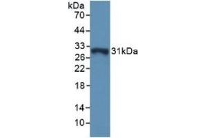 Detection of Recombinant GSTo1, Mouse using Polyclonal Antibody to Glutathione S Transferase Omega 1 (GSTo1) (GSTO1 antibody  (AA 24-233))