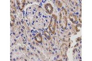 Immunohistochemistry of paraffin-embedded Rat kidney using EPHX2 Polyclonal Antibody at dilution of 1:200 (40x lens). (EPHX2 antibody)
