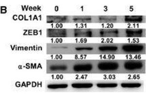 Western Blotting (WB) image for anti-Glyceraldehyde-3-Phosphate Dehydrogenase (GAPDH) antibody (ABIN2857072)