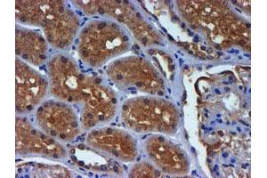 Immunohistochemical staining of paraffin-embedded Human Kidney tissue using anti-PDSS2 mouse monoclonal antibody. (PDSS2 antibody)
