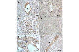 Immunohistochemistry of Rabbit Anti-collagen type III antibody. (COL3 antibody)