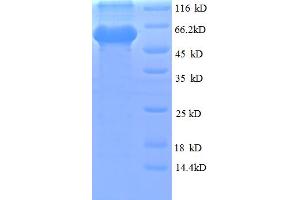 SDS-PAGE (SDS) image for Obg-Like ATPase 1 (OLA1) (AA 1-396), (full length) protein (His-SUMO Tag) (ABIN5710045) (OLA1 Protein (AA 1-396, full length) (His-SUMO Tag))