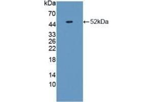 Detection of Recombinant VIM, Human using Polyclonal Antibody to Vimentin (VIM) (Vimentin antibody  (AA 2-466))