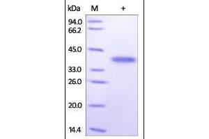 Human Arginase 1, His Tag on SDS-PAGE under reducing (R) condition. (Liver Arginase Protein (AA 1-322) (His tag))