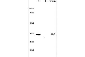 L1 human colon carcinoma lysates L2 rat brain lysates probed with Anti TRADD Polyclonal Antibody, Unconjugated (ABIN673314) at 1:200 overnight at 4 °C. (TRADD antibody  (AA 111-230))