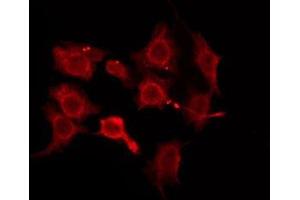 ABIN6276176 staining HeLa by IF/ICC. (OR5W2 antibody  (Internal Region))