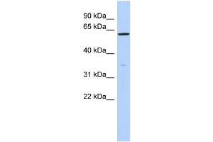 WB Suggested Anti-ZNF431 Antibody Titration:  0. (ZNF431 antibody  (N-Term))