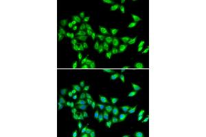 Immunofluorescence analysis of U2OS cells using KIF3A antibody (ABIN5973995). (KIF3A antibody)