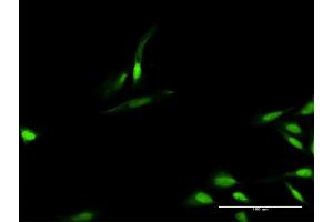 Immunofluorescence of purified MaxPab antibody to TIMELESS on HeLa cell. (TIMELESS antibody  (AA 1-1208))