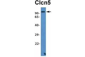 Western Blotting (WB) image for anti-Chloride Channel 5 (CLCN5) (Middle Region) antibody (ABIN2776081)