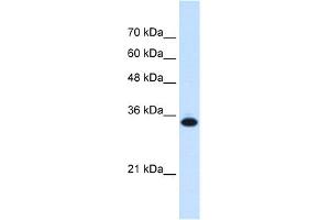 WB Suggested Anti-SLC25A38 Antibody Titration:  0. (SLC25A38 antibody  (Middle Region))