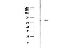 Western blot analysis of lysates from Rat brain, using AK Antibody at 1/1000 dilution.