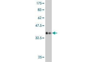 Western Blot detection against Immunogen (35. (LMO1 antibody  (AA 1-90))