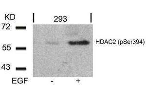Western blot analysis of extracts from 293 cells untreated or treated with EGF using HDAC2(Phospho-Ser394) Antibody. (HDAC2 antibody  (pSer394))
