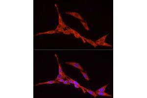 Immunofluorescence (IF) image for anti-Ribosomal Protein S18 (RPS18) (AA 1-152) antibody (ABIN6147205)