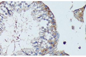 Immunohistochemistry of paraffin-embedded Mouse testis using SLC7A2 Polyclonal Antibody at dilution of 1:100 (40x lens).