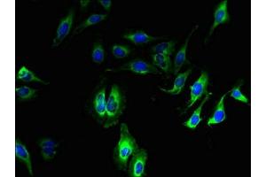 Immunofluorescent analysis of Hela cells using ABIN7148847 at dilution of 1:100 and Alexa Fluor 488-congugated AffiniPure Goat Anti-Rabbit IgG(H+L) (Cyclin-Dependent Kinase 11A (CDK11A) (AA 5-216) antibody)