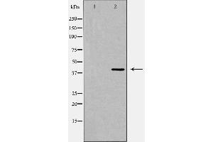 Western blot analysis of PRLHR expression in Jurkat cell extract,The lane on the left is treated with the antigen-specific peptide. (PRLHR antibody  (Internal Region))