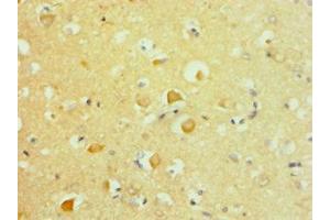 Immunohistochemistry of paraffin-embedded human brain tissue using ABIN7144051 at dilution of 1:100 (APLP2 antibody  (AA 340-450))