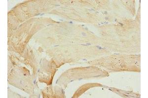 Immunohistochemistry of paraffin-embedded human skeletal muscle tissue using ABIN7163186 at dilution of 1:100 (PIP5K1B antibody  (AA 190-470))