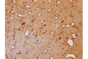IHC image of ABIN7127722 diluted at 1:100 and staining in paraffin-embedded rat brain tissue performed on a Leica BondTM system. (Recombinant PAK1 antibody  (pSer139, pSer141, pSer144))