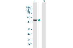 Western Blot analysis of HSD11B2 expression in transfected 293T cell line by HSD11B2 MaxPab polyclonal antibody. (HSD11B2 antibody  (AA 1-405))