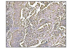 IHC analysis of HCCS using anti-HCCS antibody (ABIN7602424). (HCCS antibody  (AA 76-268))