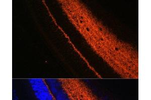 Immunofluorescence analysis of Rat eye using SYT1 Polyclonal Antibody at dilution of 1:100 (40x lens). (SYT1 antibody)