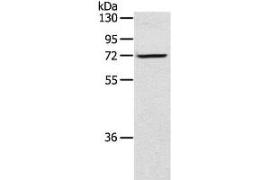 Western Blot analysis of TM4 cell using LTA4H Polyclonal Antibody at dilution of 1:300 (LTA4H antibody)