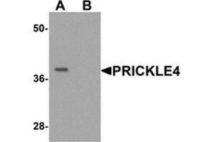 Western blot analysis of PRICKLE4 in A549 cell lysate with PRICKLE4 Antibody  at 0.