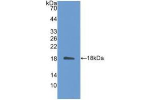 Western blot analysis of recombinant Mouse IL31.
