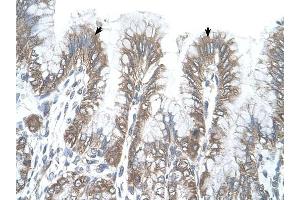RSRC2 antibody was used for immunohistochemistry at a concentration of 4-8 ug/ml to stain Epithelial cells of fundic gland (arrows) in Human Stomach. (RSRC2 antibody  (C-Term))
