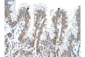RSRC2 antibody was used for immunohistochemistry at a concentration of 4-8 ug/ml to stain Epithelial cells of fundic gland (arrows) in Human Stomach.