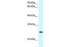 WB Suggested Anti-WWOX Antibody Titration: 1. (WWOX antibody  (C-Term))