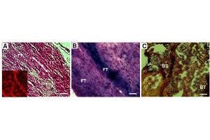 Immunohistochemistry (IHC) image for anti-COL1A2/COL1A1 antibody (ABIN5596819)