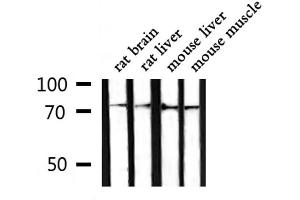 Western blot analysis of extracts from rat brain ,rat liver,mouse liver,mouse muscle, using GARS Antibody. (GARS antibody  (C-Term))