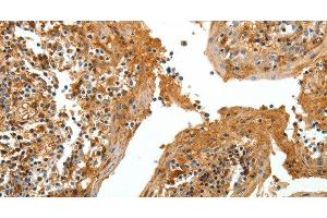 Immunohistochemistry of paraffin-embedded Human tonsil tissue using TNR Polyclonal Antibody at dilution 1:60 (Tenascin R antibody)