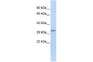 WB Suggested Anti-PDXP Antibody Titration: 0. (PDXP antibody  (Middle Region))
