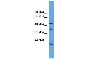 DUSP5 antibody used at 0. (DUSP5 antibody  (Middle Region))