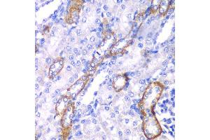 Immunohistochemistry of paraffin-embedded rat kidney using MYO1C antibody at dilution of 1:100 (x40 lens). (Myosin IC antibody)