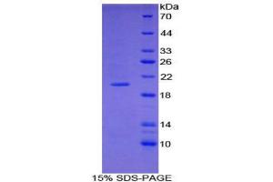 SDS-PAGE (SDS) image for Collagen, Type III, alpha 1 (COL3A1) (AA 434-643) protein (His tag) (ABIN1877742)