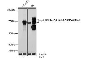 Western blot analysis of extracts of various cell lines, using Phospho-P/P/P-S474/S560/S602 Rabbit mAb (ABIN7269163) at 1:1000 dilution. (PAK4/PAK5/PAK6 (pSer474), (pSer560), (pSer602) antibody)