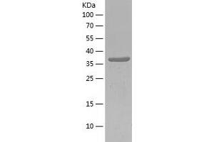 Western Blotting (WB) image for Cold Inducible RNA Binding Protein (CIRBP) (AA 1-172) protein (His-IF2DI Tag) (ABIN7282308) (CIRBP Protein (AA 1-172) (His-IF2DI Tag))