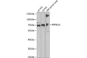 Western blot analysis of extracts of various cell lines, using PIP5K1A antibody  at 1:1000 dilution. (PIP5K1A antibody  (AA 231-500))