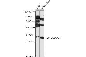 Western blot analysis of extracts of various cell lines, using ST6G antibody (ABIN6131358, ABIN6148539, ABIN6148540 and ABIN6216674) at 1:3000 dilution.