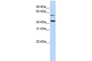 CMAS antibody used at 1 ug/ml to detect target protein. (CMAS antibody  (N-Term))