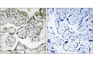 Immunohistochemistry analysis of paraffin-embedded human placenta tissue, using ME2 Antibody.