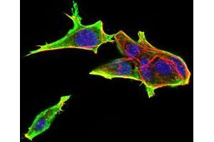 Immunofluorescence analysis of Hela cells using Rab13 mouse mAb (green).
