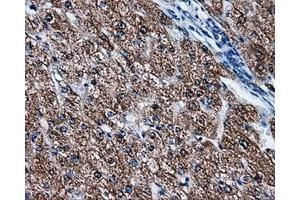 Immunohistochemical staining of paraffin-embedded liver tissue using anti-FAHD2Amouse monoclonal antibody. (FAHD2A antibody)